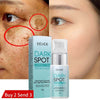 Niacinamide Whitening and Spot-Fading Cream
