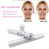 Laser Pen for Soft Scar Wrinkle Removal Treatment