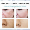 Niacinamide Whitening and Spot-Fading Cream