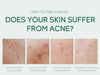 20g Moisturizing Skin Care Cream