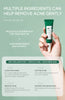 20g Moisturizing Skin Care Cream